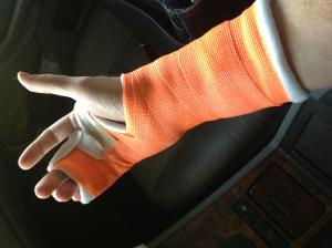 Sprained Wrist vs. Broken Wrist