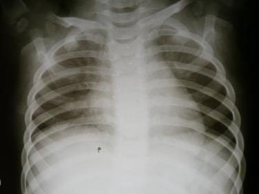 Urgent Care X-Ray