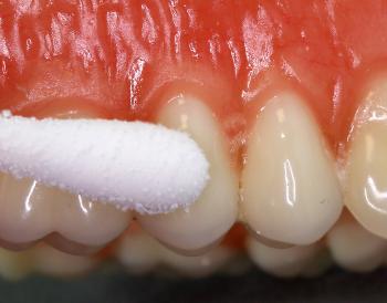 10 Easy Home Treatments For Swollen Gums | Fastmed Urgent Care
