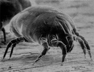 Dust Mite Allergies