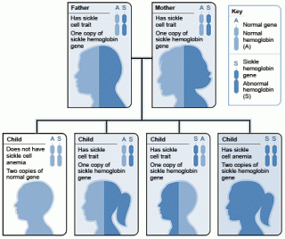 Sickle Cell Anemia