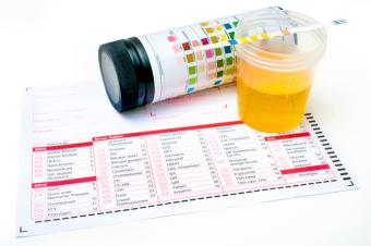 Urine Drug Screens