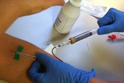 Employee drug test blood test