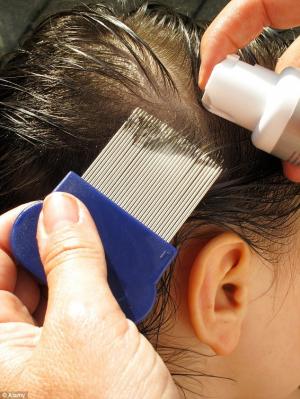 Lice Treatment