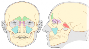 Balloon Sinuplasty Side Effects