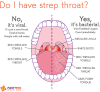 Do I Have Strep Throat