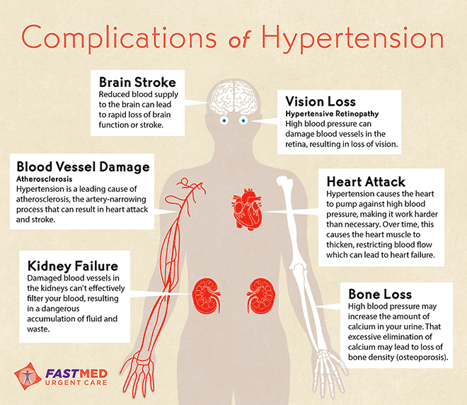 Complications of Hypertension (High Blood Pressure) [INFOGRAPHIC]