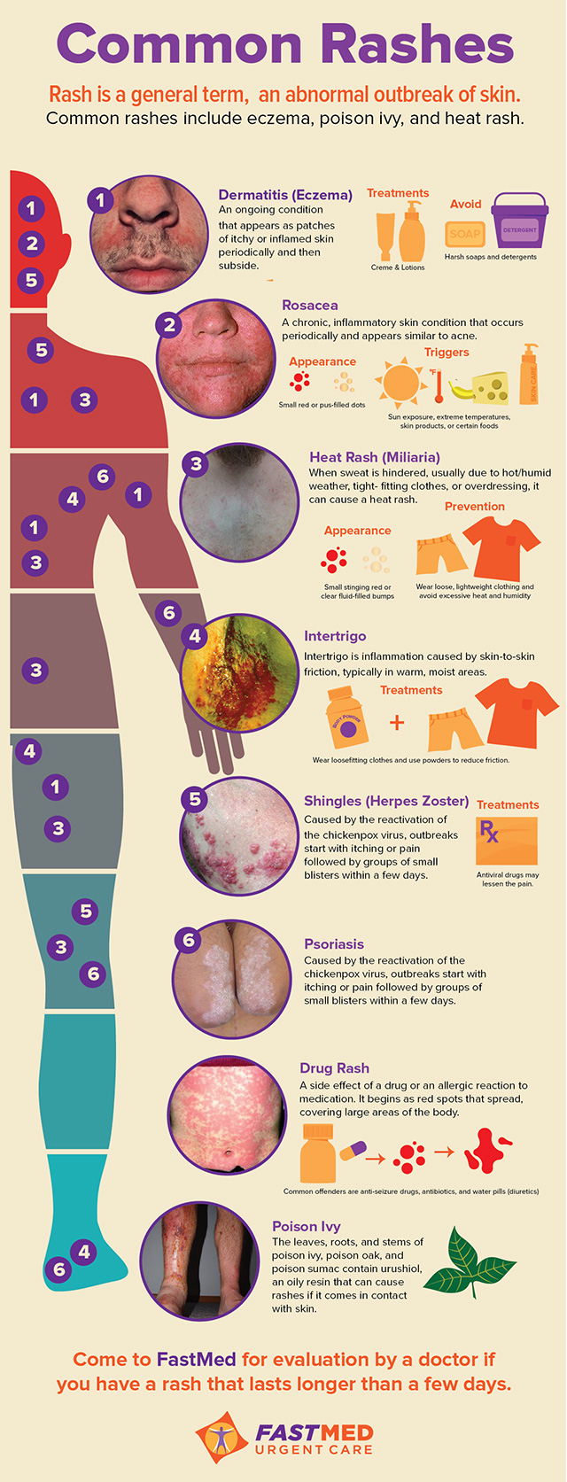 Common Rashes [INFOGRAPHIC]