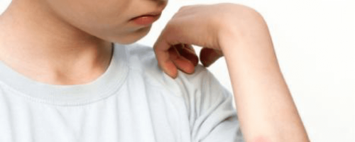 Identifying Insect Bites and Stings - HealthyChildren.org
