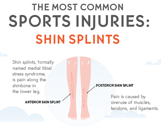 Infographic explaining shin splints