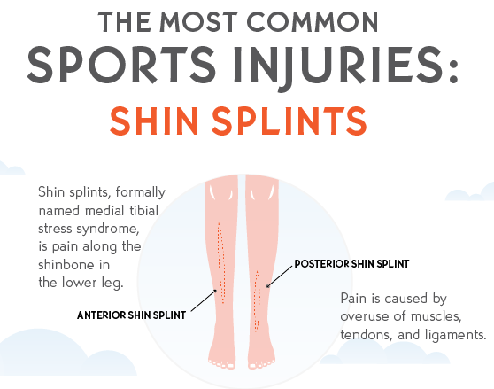 All About Shin Splints