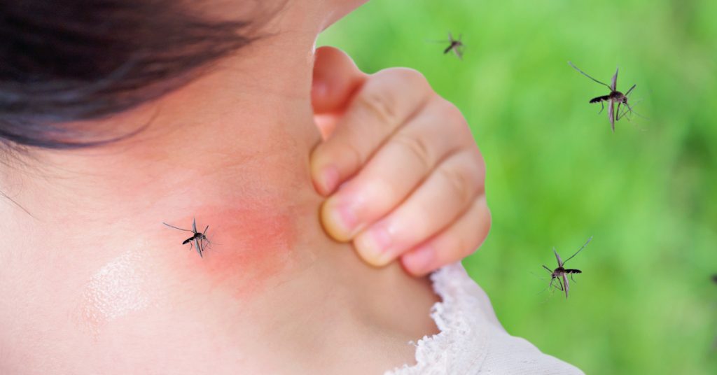Picture of someone being bitten by a mosquito.