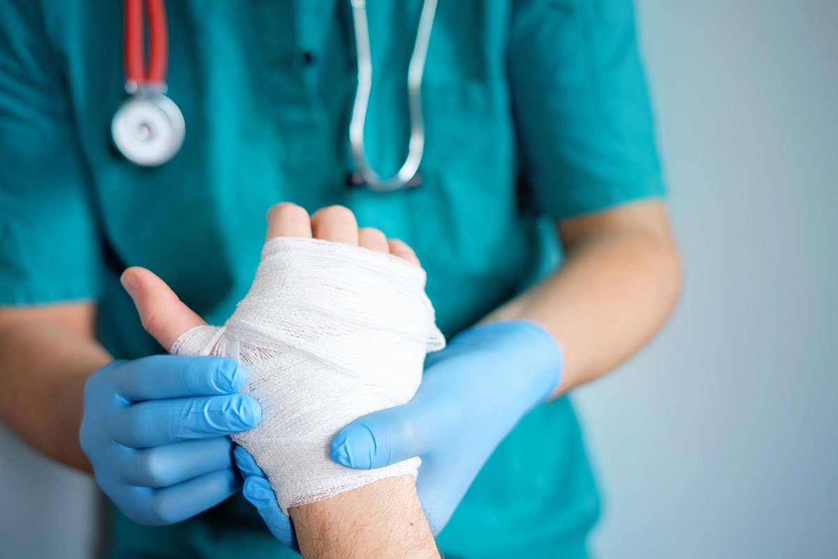 How important is first aid treatment in the healing process for a burn?