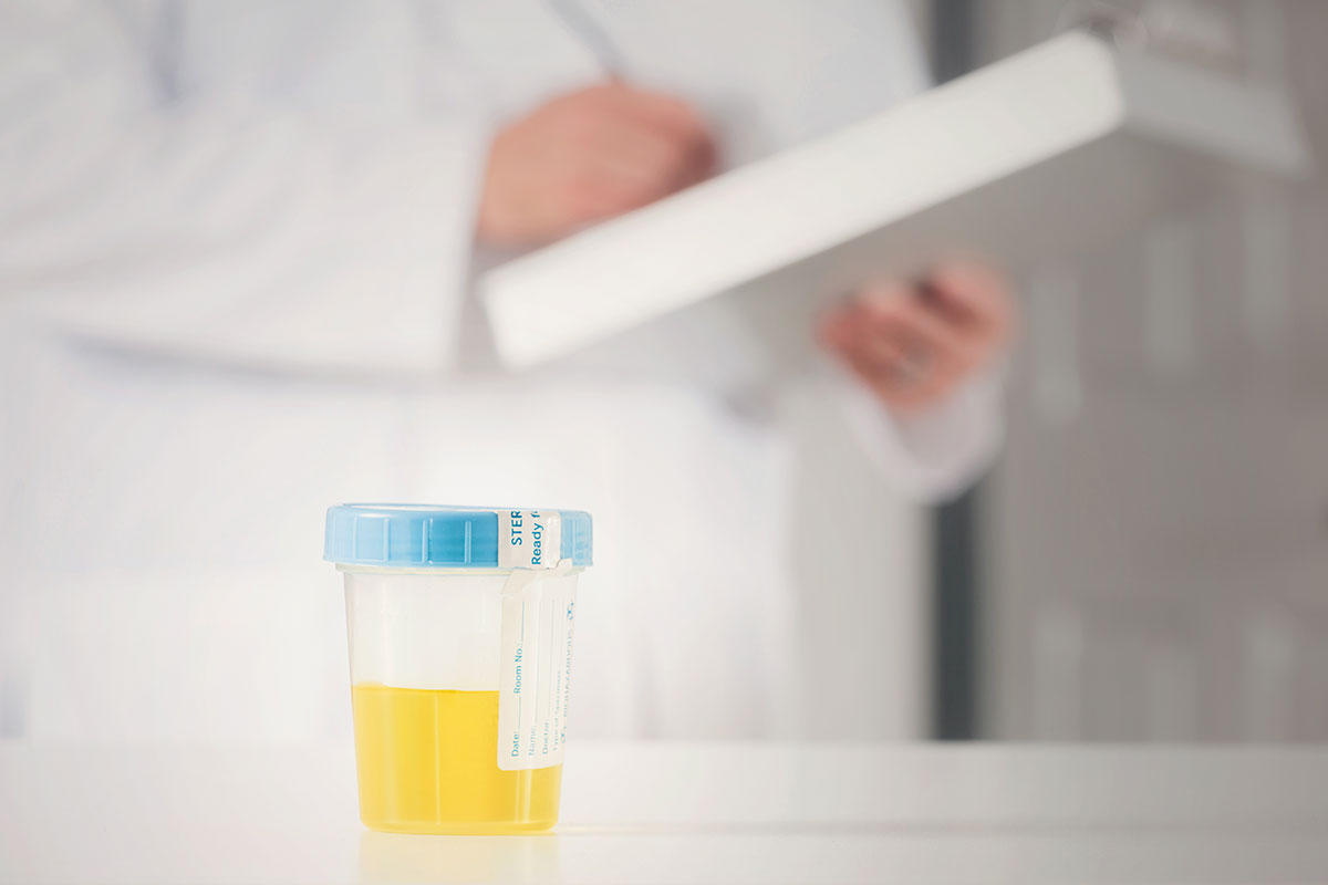 Urinalysis | Urgent care services | Medical clinics | FastMed